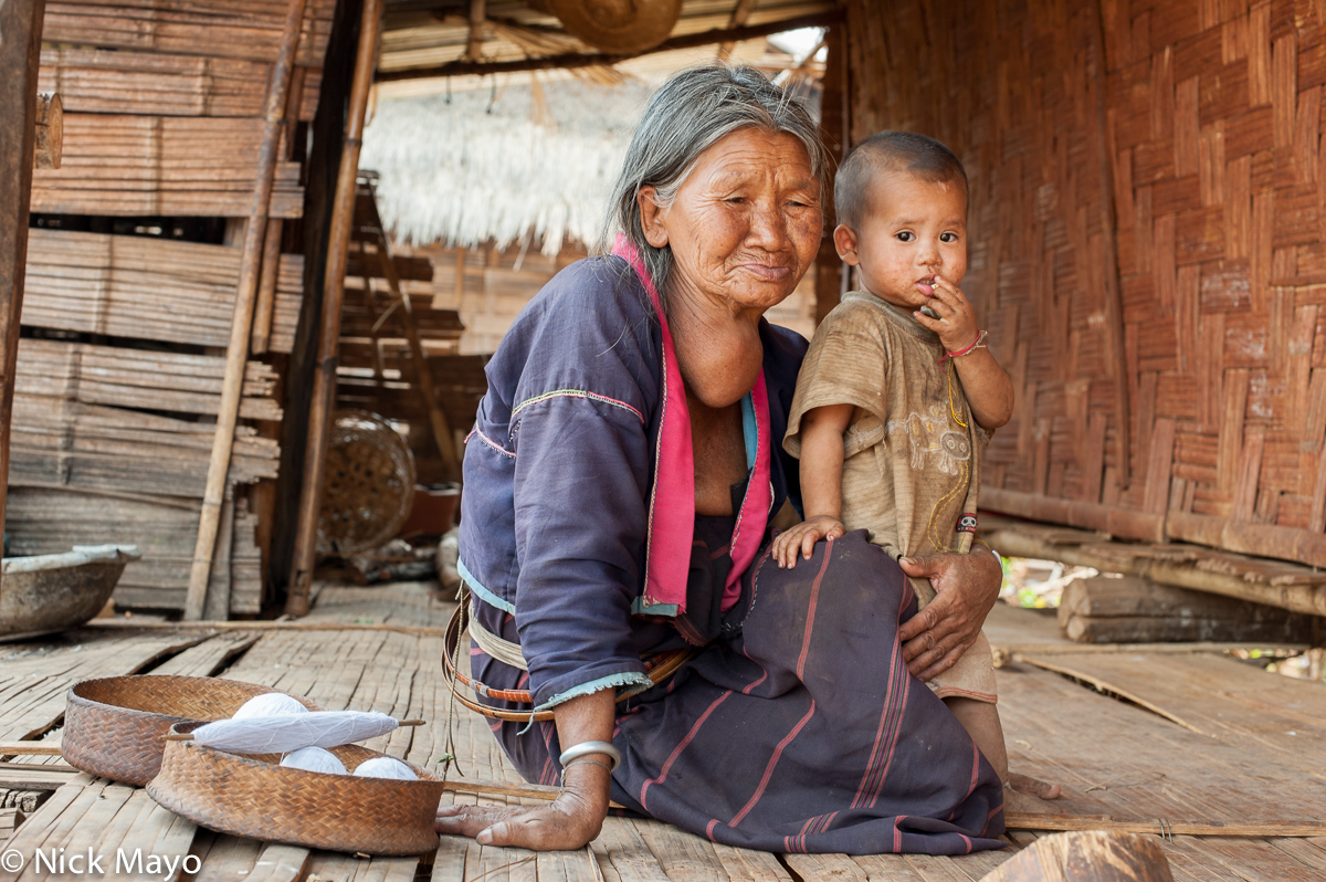 An older lady with a large goiter in the Palaung village of Namgyen.